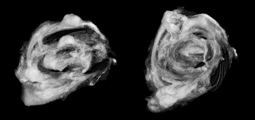 Skin care products facial foam, soap, shampoo or shower gel, abstract soap bubbles, isolated on black background