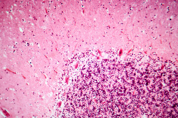 Human motor cortex, photomicrograph showing pyramidal neurons in cortical layers responsible for...