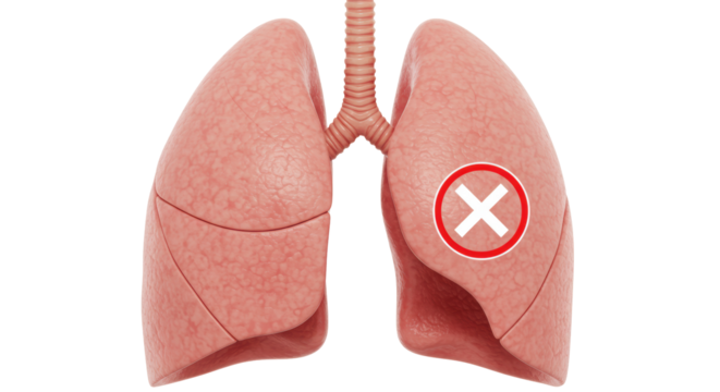 Isolated Diseased Lungs Illustration