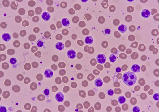 Feline Leukemia Virus: Microscopic Examination of Leukemic Cells and Erythrophage in Cat Blood