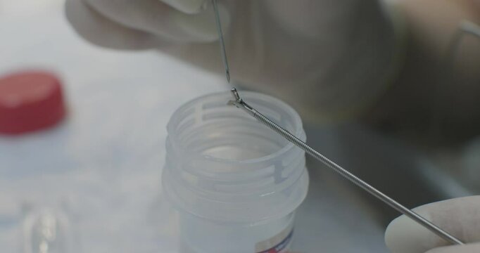 A gloved hand places a piece of biopsy taken during a gastroscopy into a jar of formalin for histological examination. A small piece of tissue is placed in a jar to be sent to the lab.