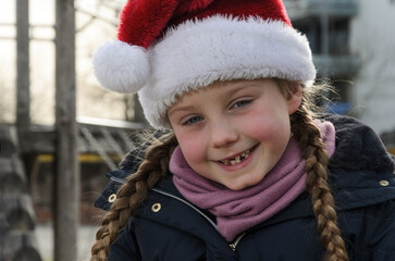 A girl with loose milk teeth.