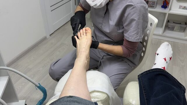 Pedicure, podiatrist. A patient for a medical pedicure procedure, corns on her foot. Foot care at a pedicure salon