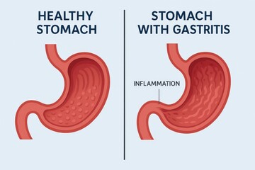 Fototapeta premium Visual comparison illustrates the differences between a healthy stomach and one affected by gastritis, highlighting inflammation and texture variations