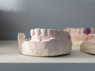Close-up of a dental prosthetic model with artificial teeth and gums on a wooden surface. Ideal for...