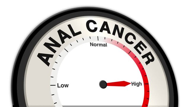 Anal Cancer text or word displayed with a barometer or tachometer-style gauge showing levels from low to normal to high, symbolizing the severity and progression of anal cancer stages health status
