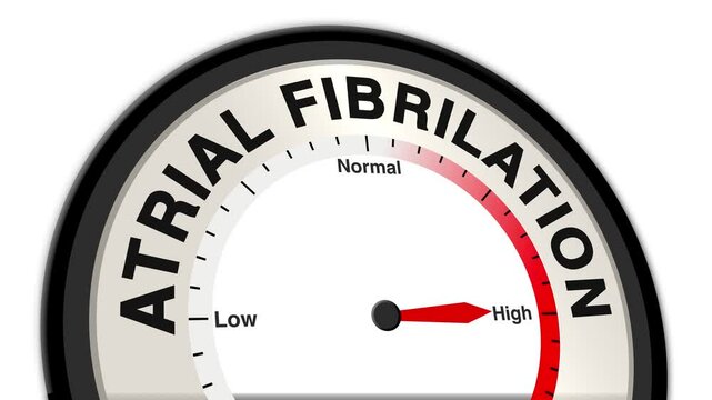 Atrial Fibrillation text or word displayed with a barometer or tachometer-style gauge showing levels from low to normal to high, symbolizing heart health and monitoring risk