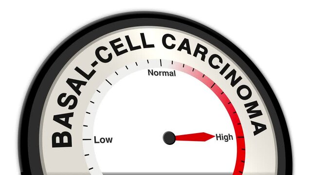 Basal-cell carcinoma text or word displayed with a barometer or tachometer-style gauge showing levels from low to normal to high, representing the risk and progression of skin cancer