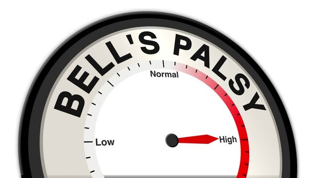 Bell's Palsy text or word displayed with a barometer or tachometer-style gauge showing levels from low to normal to high, symbolizing the severity of facial paralysis