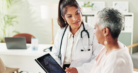 Doctor, senior woman and tablet for x ray results, lungs assessment and medical exam at hospital....