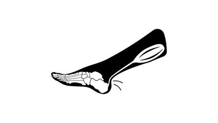 Achilles tendinopathy, black isolated silhouette