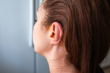 The girl's face and ear after otoplasty. Close-up. 3 days after the operation. Plastic