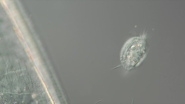 Der Einzeller Euplotes ist ein Wimpertier aus einem Tropfen S&uuml;&szlig;wasser unter dem Mikroskop