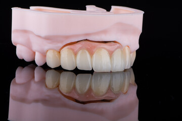 High-quality naturally dental single crowns made of zirconium for fixation to the frontal teeth of upper jaw. © gorynvd