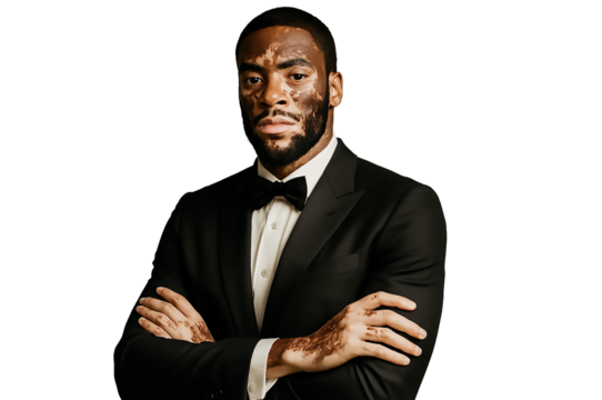 Confident man in black elegant dress with vitiligo isolated on transparent background