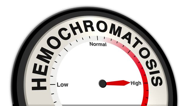Hemochromatosis text or word shown with a barometer or tachometer-style gauge, representing varying levels of iron accumulation and organ damage risk