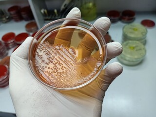 Microbiologist hold urine sample on agar media plate in laboratory background. Colonies of Candida albicans