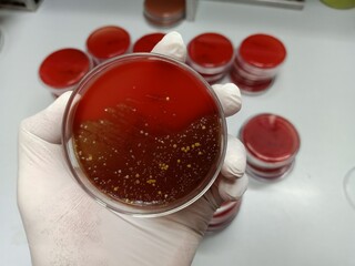 Microbiologist hold Bacteria culture growth on a petri dish in the microbiology lab. gram-positive...