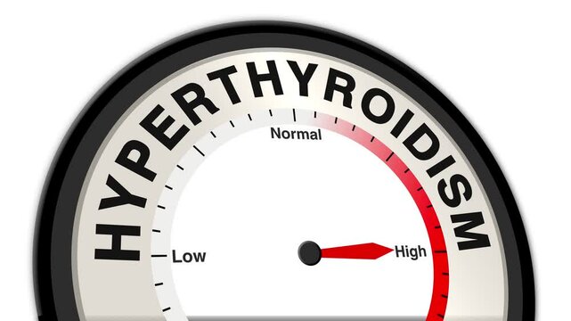Hyperthyroidism text or word shown with a barometer or tachometer-style gauge, representing varying levels of thyroid hormone excess and its impact on metabolism, energy, and overall health