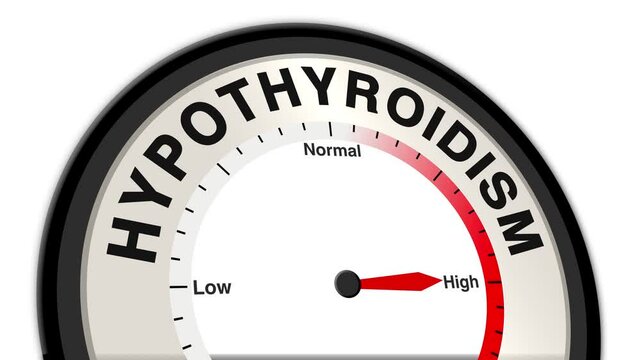 Hypothyroidism text or word shown with a barometer or tachometer-style gauge, representing varying levels of thyroid hormone deficiency and its impact on metabolism, energy, and overall health