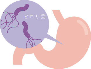 ピロリ菌のイラスト Helicobacter pylori illustration