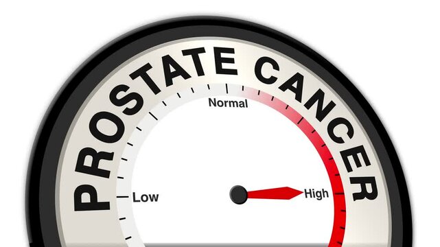 Prostate Cancer text or word shown with a barometer or tachometer-style gauge, representing varying levels of disease progression and severity in the prostate