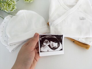 A hand holding a baby ultrasound photo next to soft white baby clothes and hats, symbolizing pregnancy and preparation for a newborn.