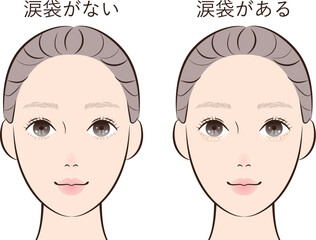 涙袋あり・なしビフォーアフター｜美容・メイク・整形比較