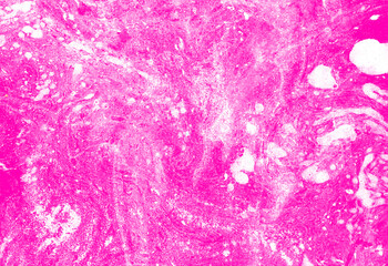 Fototapeta premium Abstract texture background. Chaotic white spots on fuchsia pink. Colors mix with each other forming new shades. Different textures, dots, drops, blurs.