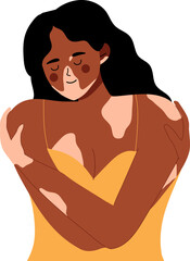 Fototapeta premium woman hugging herself with skin problems. Body positive self love. World vitiligo day.