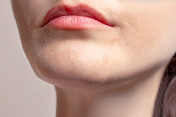A woman's chin grows blonde and dark hair. Woman's beard grows. Cropped close up photo