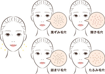 鼻の毛穴トラブル4種類セット｜たるみ・詰まり・黒ずみ・開き毛穴のイラスト素材