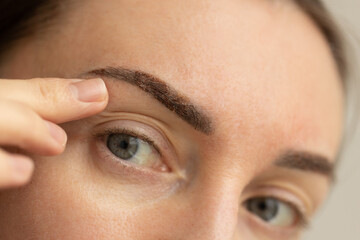  Woman with eyebrows one week after permanent makeup. 
