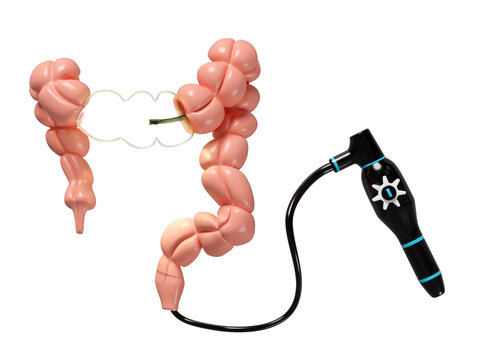 Colonoscopy to find the cause of disease isolated. check digestive, intestine health concept, 3d illustration render