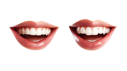 Two smiling lips with teeth showing. One is a close-up of a woman's mouth. The other is a close-up of a man's mouth
