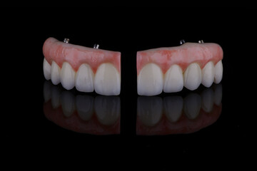 Two dental bridges with artificial gum made of zirconium on titanium bar for fixation upper teeth.