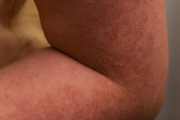 Problemy sk&oacute;rne