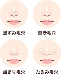 鼻の毛穴トラブル4種類セット｜黒ずみ・開き・詰まり・たるみ毛穴の鼻アップ素材