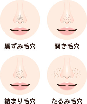 鼻の毛穴トラブル4種類セット｜黒ずみ・開き・詰まり・たるみ毛穴の鼻アップ素材
