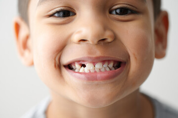 Happy hispanic child with missing tooth smiling close-up portrait