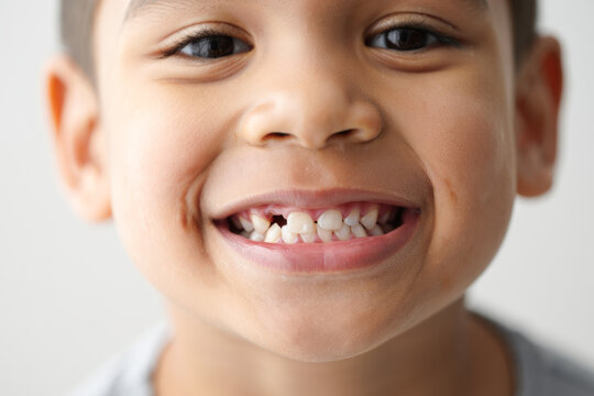 Happy hispanic child with missing tooth smiling close-up portrait - Powered by Adobe