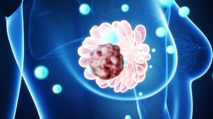 Drug molecules entering the mammary gland, breast hyperplasia treatment, breast cancer treatment, breast malignancy treatment, female breast anatomy, mammogram, 3D rendered medical animation