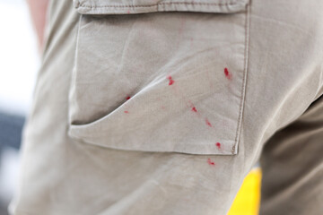 Close-up of stained trousers from the back. Traces of women's lipstick on trousers.