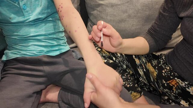 A child illness skin rash epidemic with vaccination indoors