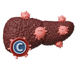 Medical and health science 3d icon. Liver with hepatitis C virus indicating cirrhosis from viral infection.