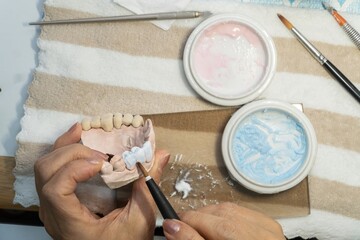 Close-up of a dental technician’s hands made a dental model with precision, showcasing artistry and professional expertise