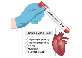 Cardiac markers test are biomarkers measured to evaluate heart function.