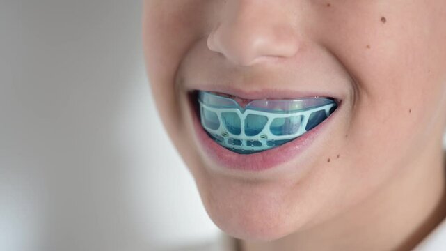 Teen boy put mouthguards on his mouth on white background. Blue mouthguards made of silicone or thermoplastic material.