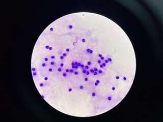 The slide shows a large number of white blood cells, appearing as round or irregularly shaped cells with distinct nuclei. These cells are scattered across the field.
