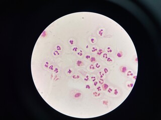 The slide shows a large number of white blood cells, appearing as round or irregularly shaped cells with distinct nuclei. These cells are scattered across the field.